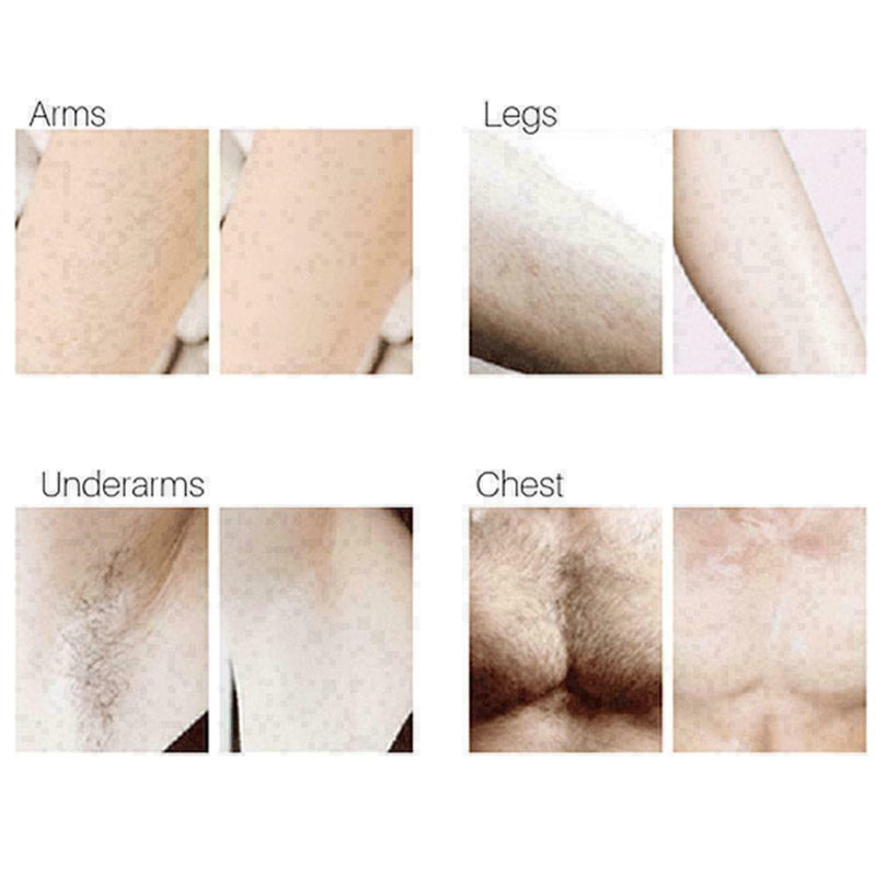 100% Natural Effective Permanent Hair Removal Spray Smooth Wax Treatment Bo P1E5