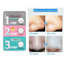 Remove Blackhead 3 Steps Care Deep Clean Pores Acne Nose Patch (Blue)