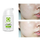 Pretty Cowry Whitening Aloe Vera 100% Pure Effective Moisturizing Hyaluroni