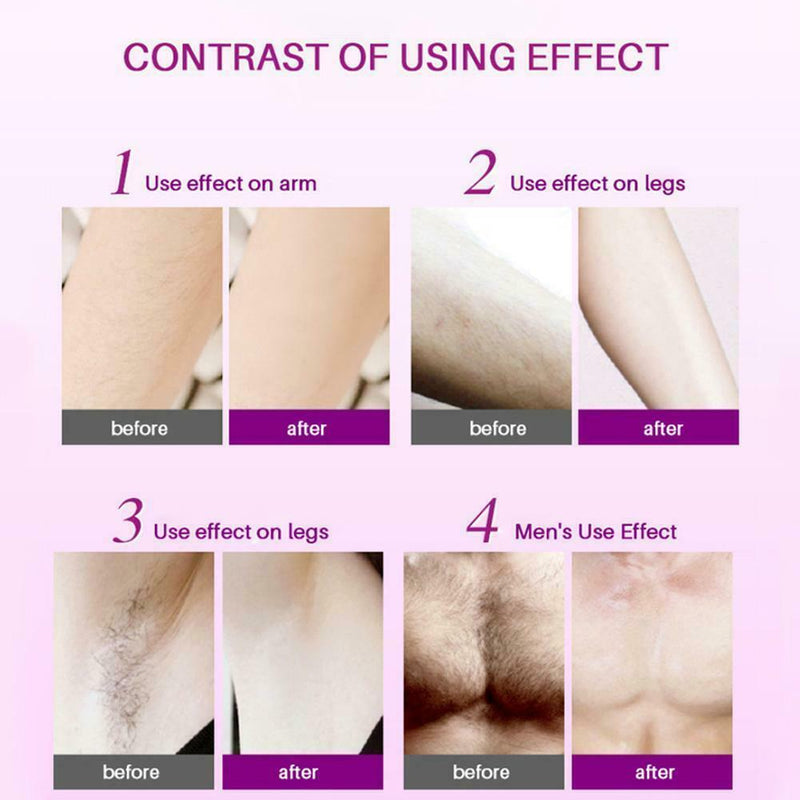 Spray & Wipe Hair Removal Spray Painless Remover Hair Body Care