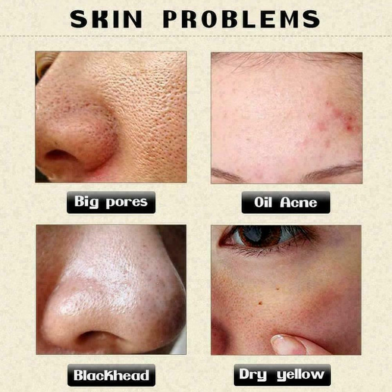 Hyaluronic Acid Ampoule Face Serum Shrink Pores Anti-Ance Nicotinamide H1Z7 X7K6