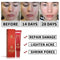 15ml Crema Acne para ELIMINA Barros Manchas Espinillas I8P7 Tu RECUP Piel L U6O8
