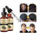 50ML Castor Oil Germinal Hair Growth Serum Hairdressing Oil Treatement Loss B7Z0