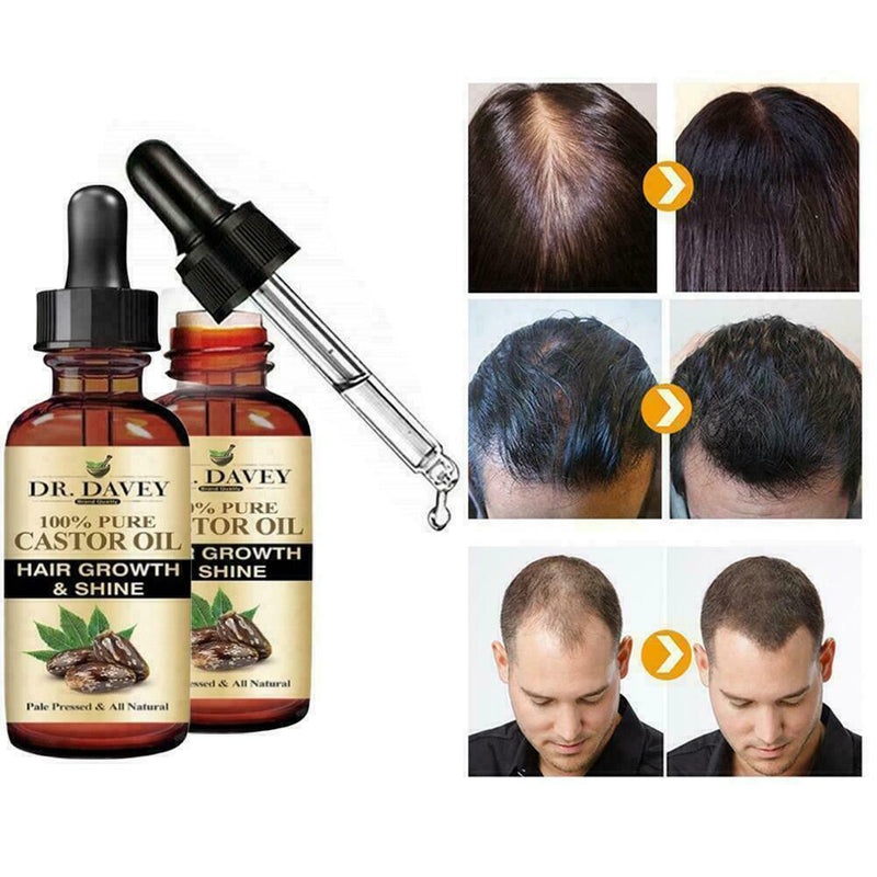 50ML Castor Oil Germinal Hair Growth Serum Hairdressing Oil Treatement Loss B7Z0