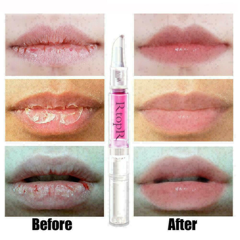 Lip Plumper Repairing Reduce Fine Lines Increase Moisturizing Lips Beauty F M0Z0