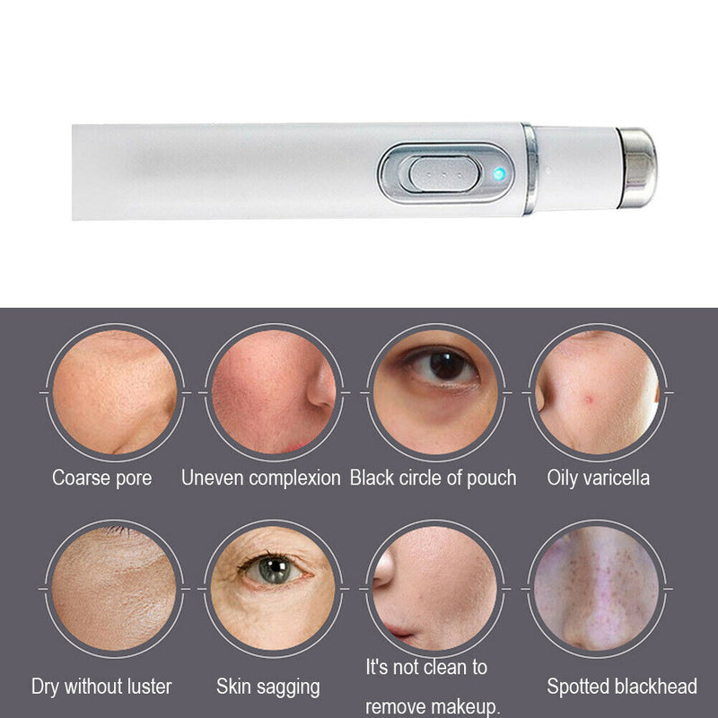 Blue Light Acne Removal Pen Eye Bag Dark Circle Removing Stick Eye Massager