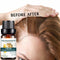 Ginger Fast Hair Growth Essence Essential Oil Anti-Hair Loss Fluid Hair Care