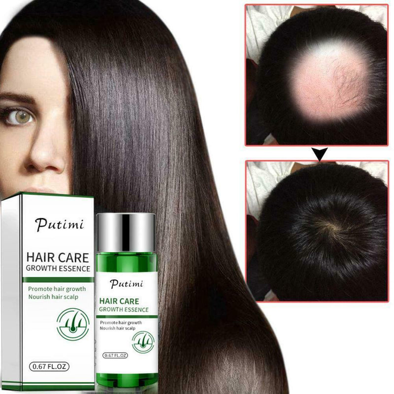 Hair Growth Dense Regrowth Ginger Serum Oil Anti Loss Treatment Essence 20ML