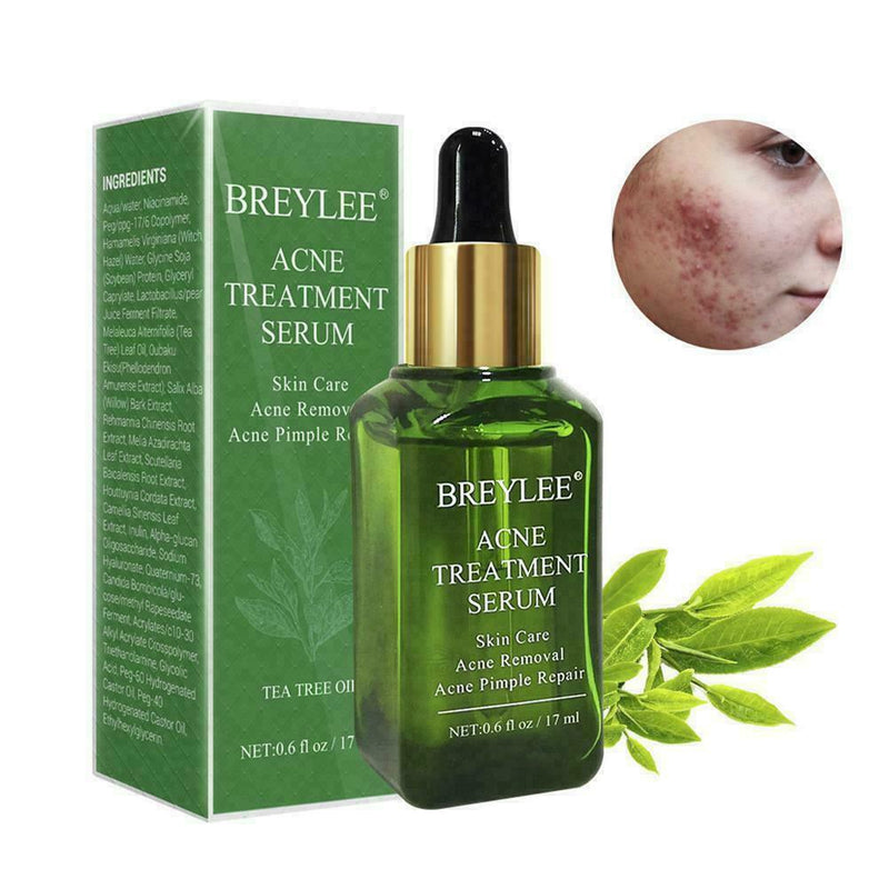 Shrink Pores Essence Facial Serum Blackhead Acne Face Essence Oil E5A0 O3W0