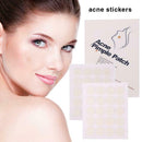 40Pcs Acne Remover Pimple Patch Stickers Tag Removal Facial Spot