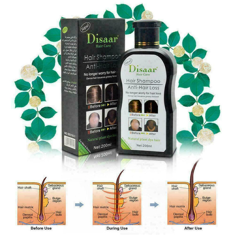 200ml Hair Shampoo Anti hair Loss Herbal Rapid Hair For Men Best Women Grow L5H3
