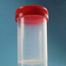 60ml Hospital Urine Collection Sample Cup Specimen Bottle_Container L4X3