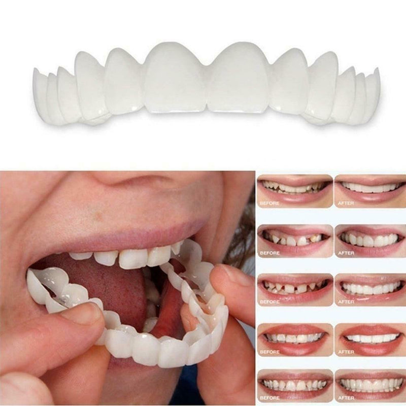 Dental Orthodontic Beauty Teeth Corrector Braces Tooth Retainer Straighten- top
