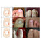 Footcare Oil 15ml Gehwol Nail Softner Fluid Ingrown Nails Callus Toe Z2L1