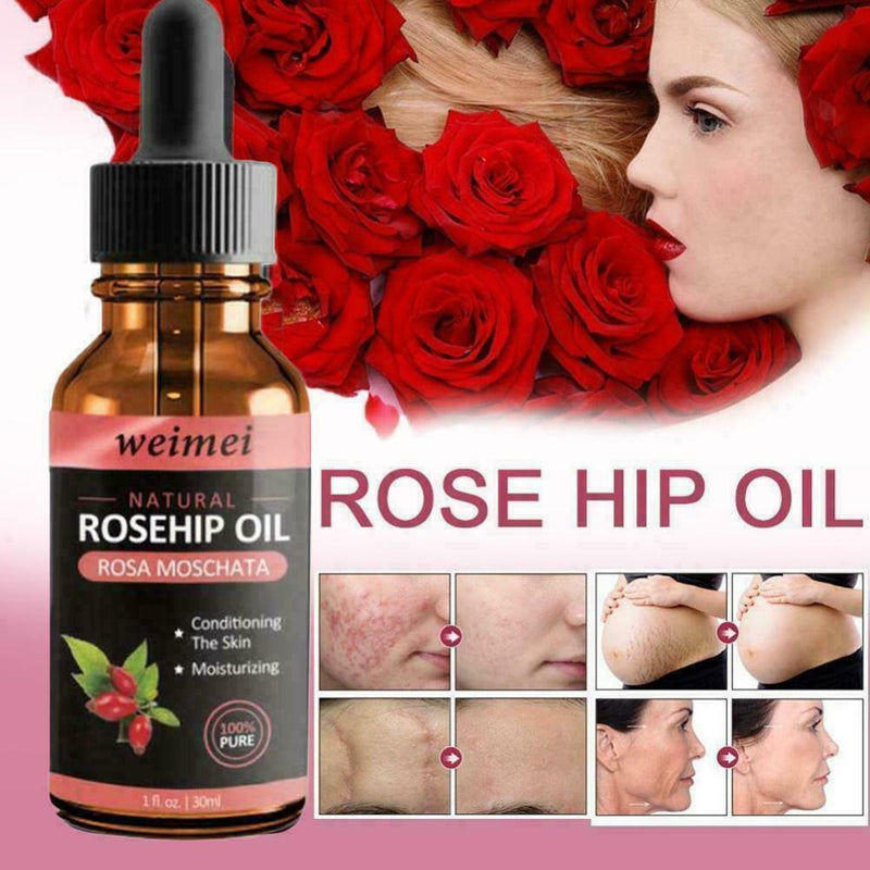 Skin Whitening Oil Brightening Dark Spot Removal 30ml Quality Essence Care V6S1