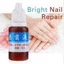 10ml Nail Repair Treatment Liquid Cleanser Onychomycosis Disinfect Water ne O7A1