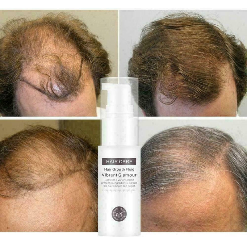 Hair Growth Essence Essential Oil Liquid Spray Nourish Shiny Thick Roots Pr O4G6