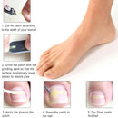 Ingrown Toe Nail Correction Kit Toenail Treatment Nail Pusher Recover Foot C Pg