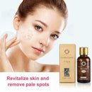 Ultra Brightening Spotless Oil Anti Dark Natural Spots Pure Oil Skin Care F D2Q8
