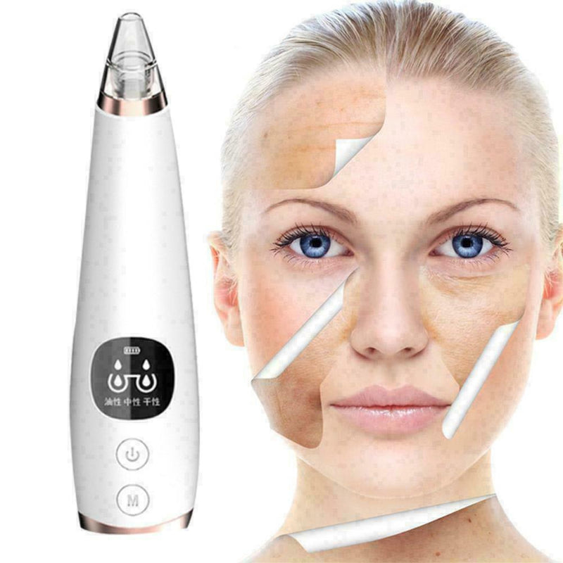 Blackhead Remover Vacuum Suction Facial Acne Pore Cleaner Extractor For Uni N5E2