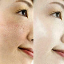 Hyaluronic Acid Ampoule Face Serum Shrink Pores Anti-Ance Nicotinamide D8Q4 N0D5