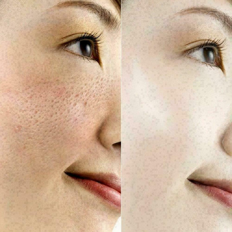 Hyaluronic Acid Ampoule Face Serum Shrink Pores Anti-Ance Nicotinamide D8Q4 N0D5