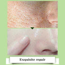 10ml Face Essence Care Hyaluronic Whitening Shrink Pores X4C2 K7R9 D8L6 O2V1