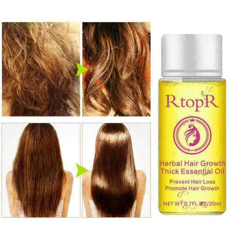 Fast Powerful Hair Growth Essential Oil Liquid Treatment Preventing Hairs L A3X3