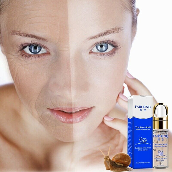 Fair King Tea Tree Hyaluronic Acid Snail Plant Extract Face Serum Whitening W5H6