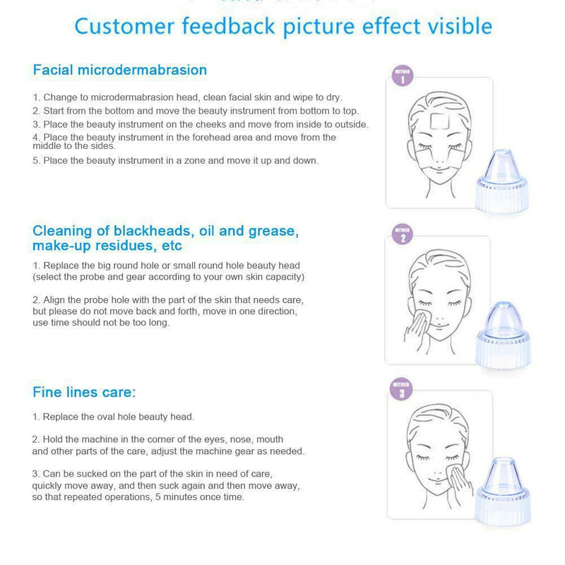 Facial Acne Blackhead Remover Vacuum Suction Pore Clean Machine (White B) SN9F