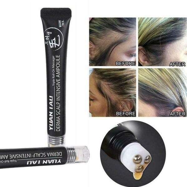 20ml Scalp Intens Roll-on Hair Growth Serum Hair Growth Hair Loss Essence