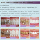 Rtopr Teeth Oral Hygiene Essence Whitening Essence Daily Use Effective Remo