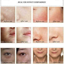 Schlangengift-Extrakt Gesichtscreme Anti-Falten-Whitening Versor I1D0 U0J1 T1W2