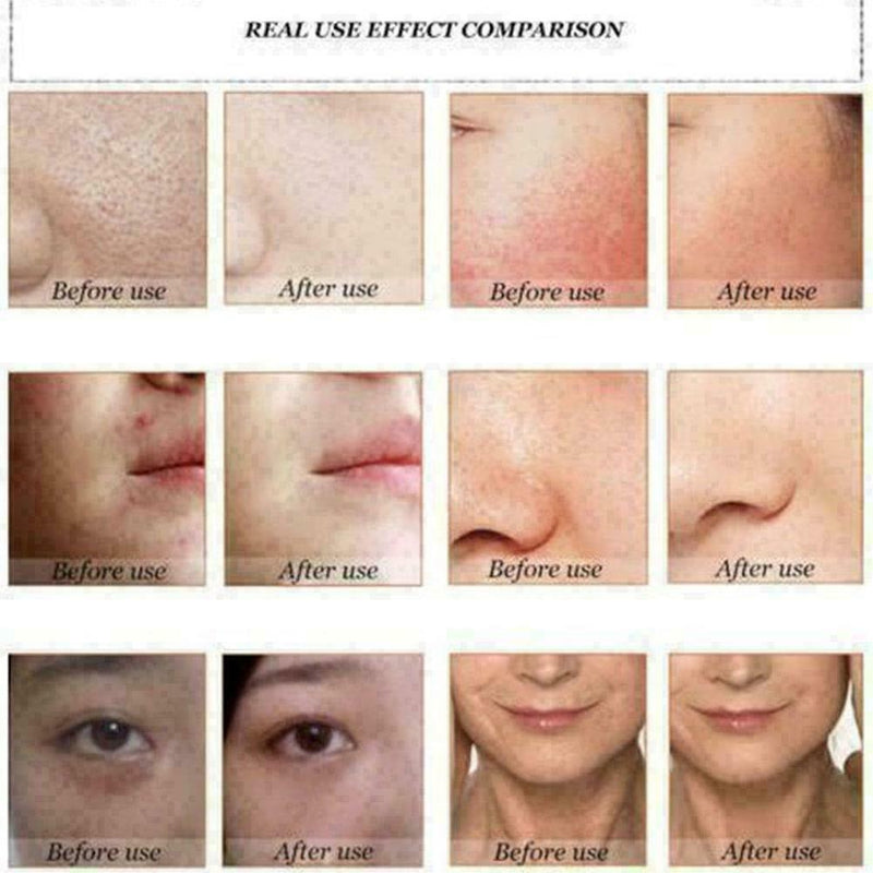 Schlangengift-Extrakt Gesichtscreme Anti-Falten-Whitening Versor I1D0 U0J1 T1W2