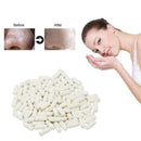 20* Amino Acid Cleansing Powder Capsules Acne Removal Pore Oil S7Y9 Control Q7F6
