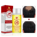20ml Natural Ginger Extract Essential Oil Fast Hair Growth Loss Treatment â„–[