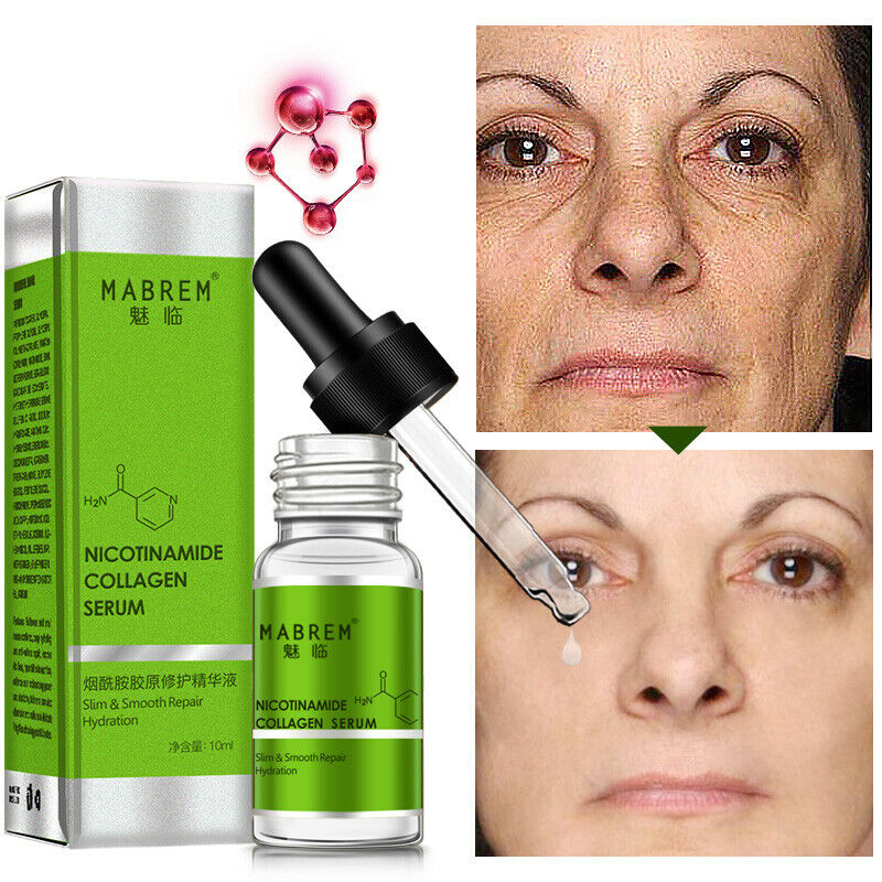 MeiYanQiong Nicotinamide Collagen Repair Solution Serum Repair Skin Anti-Ag G5P9