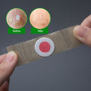 Foot Corn Removal Plaster Thorn Patch Feet Callus Remove Pain Relief Stick ME