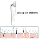 Sonax Pro Face Nose Acne Black Dot Pimple Blackhead Remover Electric Black