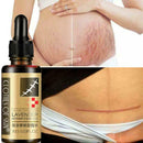 Lavender Essence Skin Care Natural Pure Remove Ance Mark Burn Strentch Remo H0D9