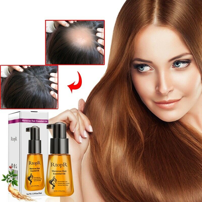 RtopR Moroccan Prevent Hair Loss Product Hair Growth Essential Oil Easy To  Z4D9