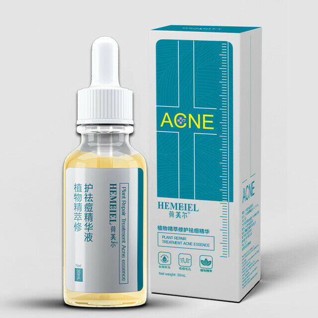Hemeiel Shrink Pores Serum Acne Treatment Liquid Moisturizing Face Serum An T8W9