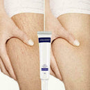 Entfernung Akne Narbe Stretch Marks Creme Fett Narbe Beha Striae Gravidarum Q2M9