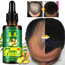 30ml Extract Hair Growth Essence Oil Anti Hair Loss Fast Restoration Growth X9H6