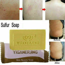 Natural Sulfur Acne Anti Fungus Bath Shower Soap Health Care Hotel Bathroom New