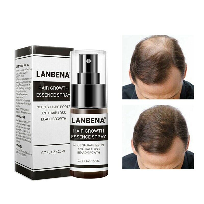 Lanbena Fast Powerful Hair Growth Products Hair Spray Essence Anti Hair Fal N8O9