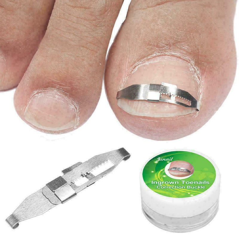 Ingrown Toe Nail Correction Pedicure Straightener Clippers Recover B3M0
