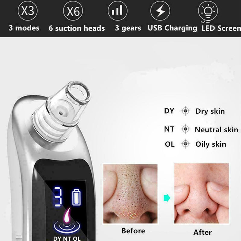 Electric Acne Blackhead Vacuum Cleaner Skin Care Tool Nose Clean Face Pores I0B8