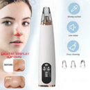 Electric Blackhead And Acne Pores Vacuum Suction Microdermabrasion Cleaner L9N6