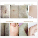 Entfernung Akne Narbe Stretch Marks Creme Fett Narbe Beha Striae Gravidarum Q2M9